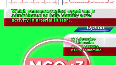 Arterial flutter #flutter -#arterialflutter #arrthythmia #CardiacArrhythmia #Cardiology 3D Medico