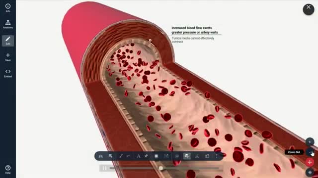 Causes of High Blood Pressure