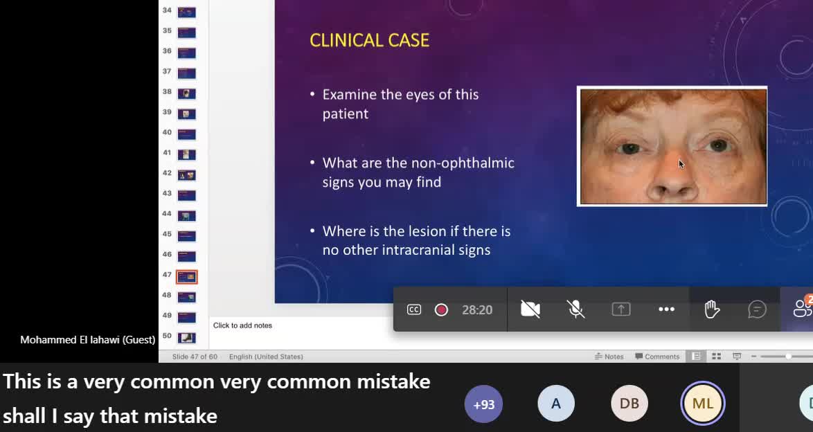 ST3.Examine the eyes of this lady and follow commands Lahawi