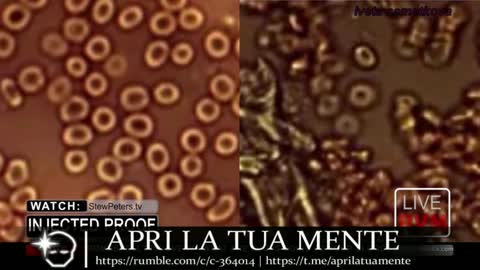 La Dott.ssa Jane Ruby spiega cosa fanno le iniezioni dei vaccini al tuo sangue