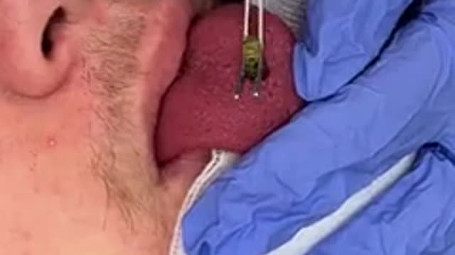 This came out of his tongue..._2