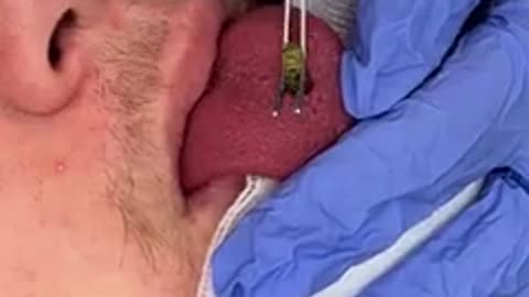 This came out of his tongue..._2