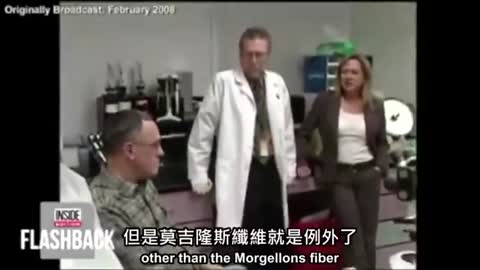 PCR測試棒子上的奈米機器纖維 會動唷 鑽進你的腦 #莫吉隆斯纖維