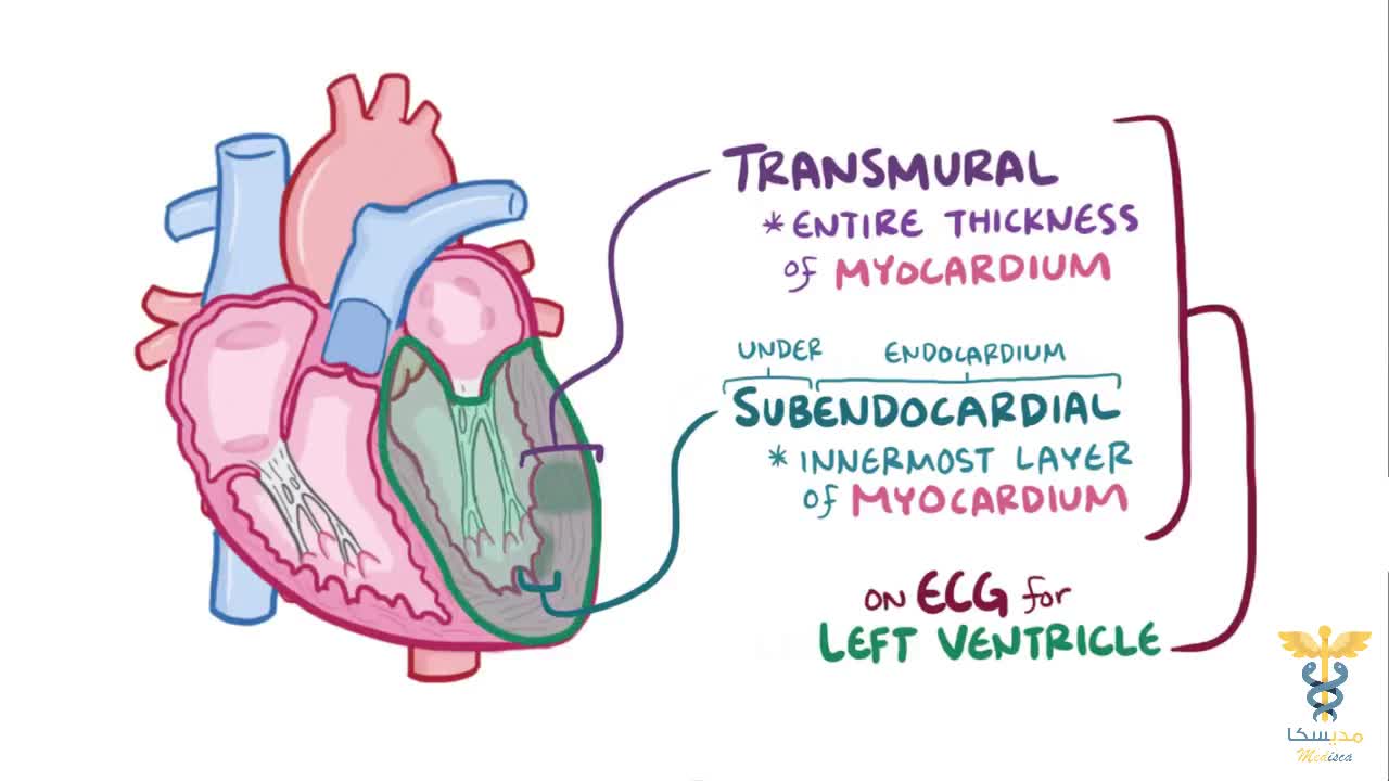 8 ECG cardiac infarction and ischemia