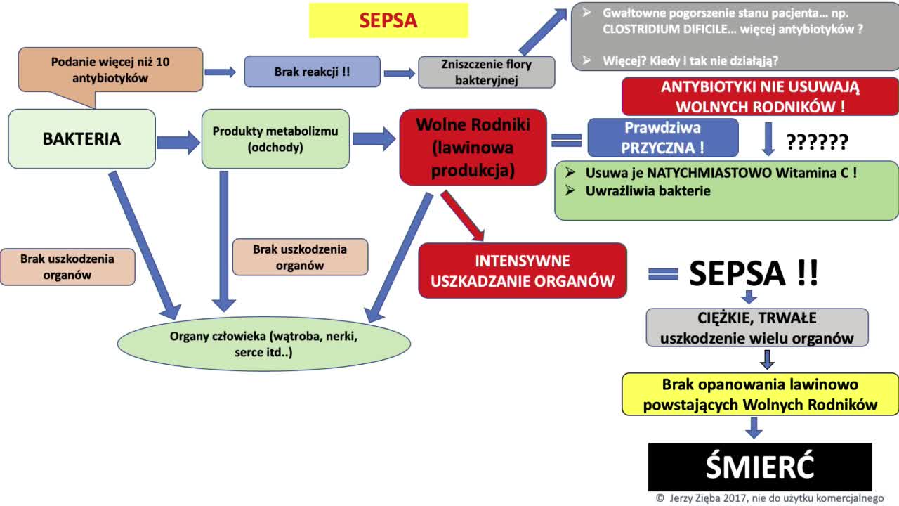 Wszystko na temat sepsy - Jerzy Zięba