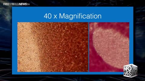 Discoloured and Deoxygenated blood cells