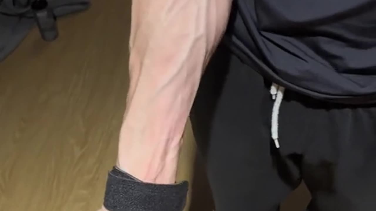 Veins make me grossed out!!