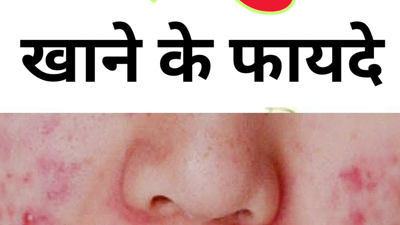 कच्चे लहसुन खाने के फायदे