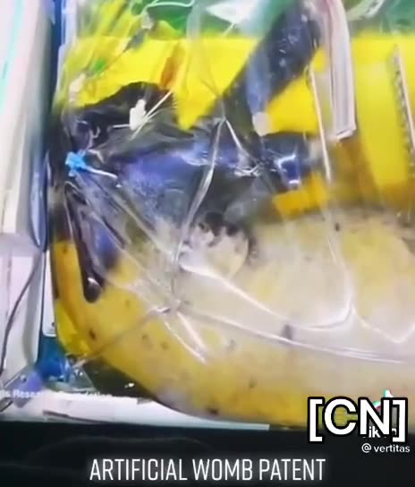 ARTIFICIAL WOMB PATENT‼️‼️‼️