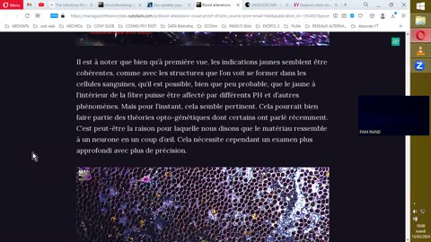 INVAXXXION NanoACTUELLE