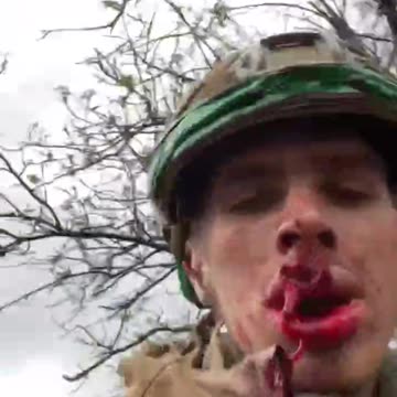 Ukraine vinder #1 🤡