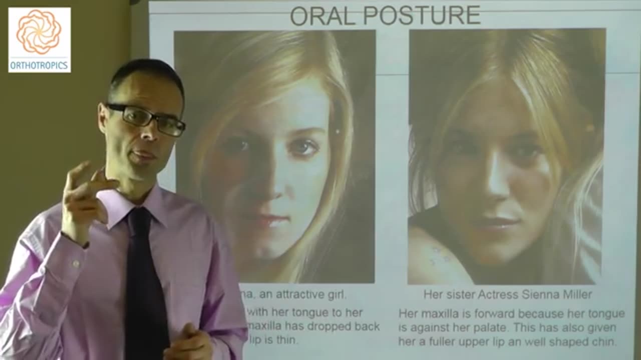 Does Bad or Proper Oral Posture Have Influence on Facial Beauty & Attractiveness by Dr Mike Mew