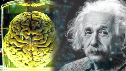 How Einstein's Brain was Different