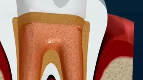 Root Canal Treatment Doctors in Mohali – Esthetica Dental Chandigarh