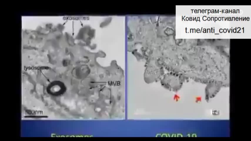 Экзосомы выдают нам вместо вируса ''ковида''