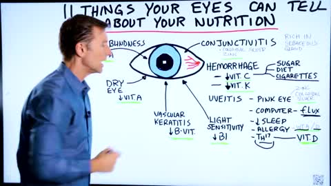 DrBerg-11 Things Your Eye Health Tells You About Nutrition