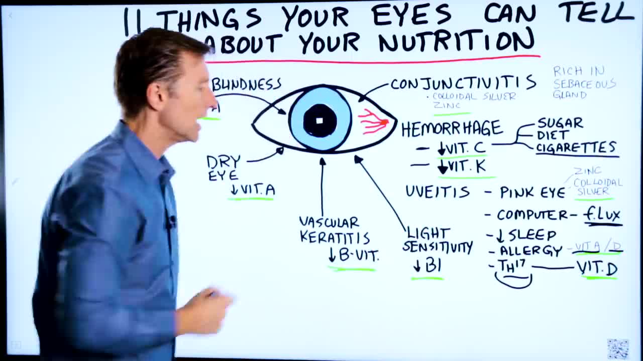 DrBerg-11 Things Your Eye Health Tells You About Nutrition