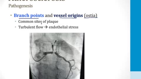 Cardiology - 2. Cardiac Ischemia - 1.Atherosclerosis