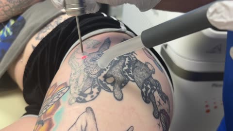 Tattoo artist getting multiple tattoos removed