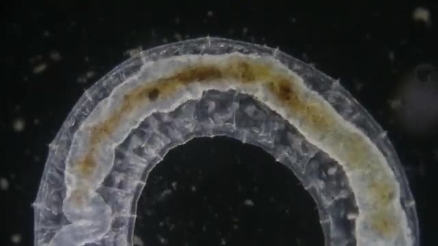 Earthworm Under Microscope_Cut