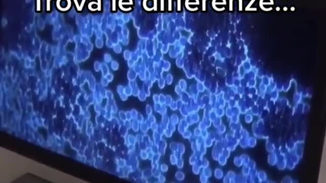 Ottimo video sulle cure del DR. Giovannini per gli effetti collaterali da vaccini