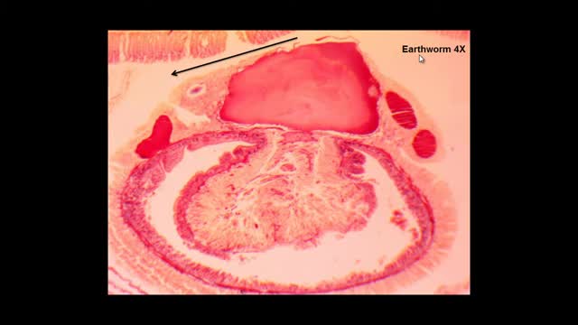 Earthworm Cross Section_Cut