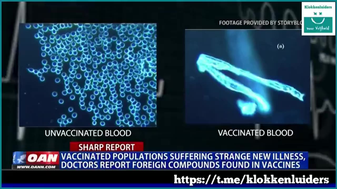 Covid Vaccinated Populations Suffering strange new illness