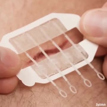 ►🚨▶◾️⚡️ Painless stitches. Wait.. what?