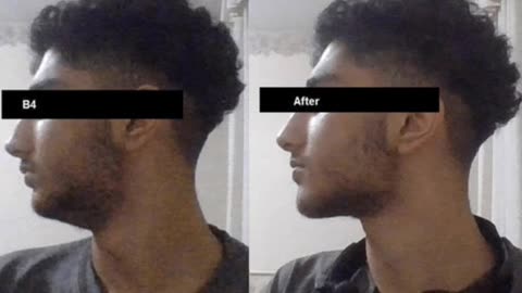 **unreal** mewing transformation!