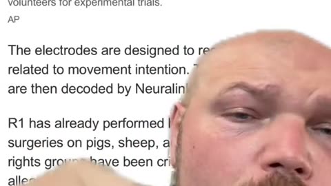 ELON’S “NEURALINK” IS LOOKING FOR VOLUNTEER TO HAVE A PIECE OF THEIR SKULL CUT OPEN BY A ROBOTIC SURGEON