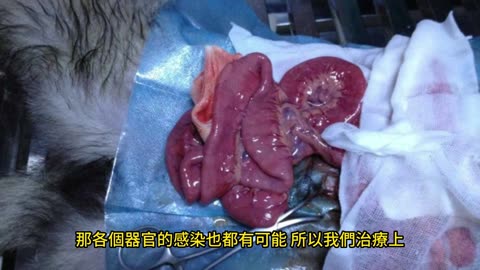 警覺細菌感染 致死風險高