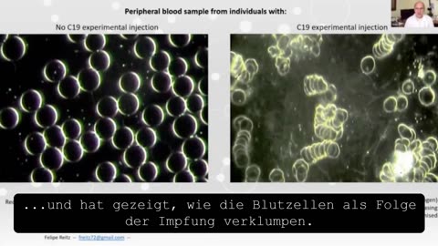 Shocking Thermography results of injected persons!