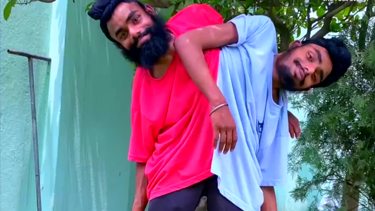 Siamese twins live,work, inspire together. Siamese twins are born in 1 for 500000 cases.