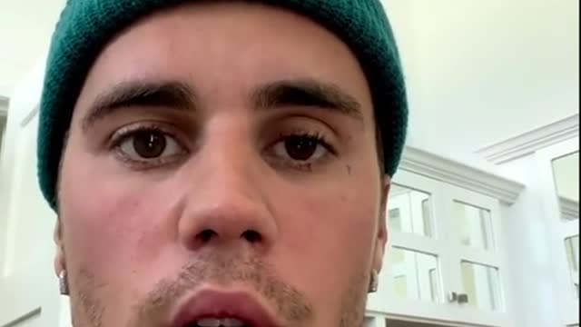Justin Bieber reveals he has facial paralysisaqaig usn