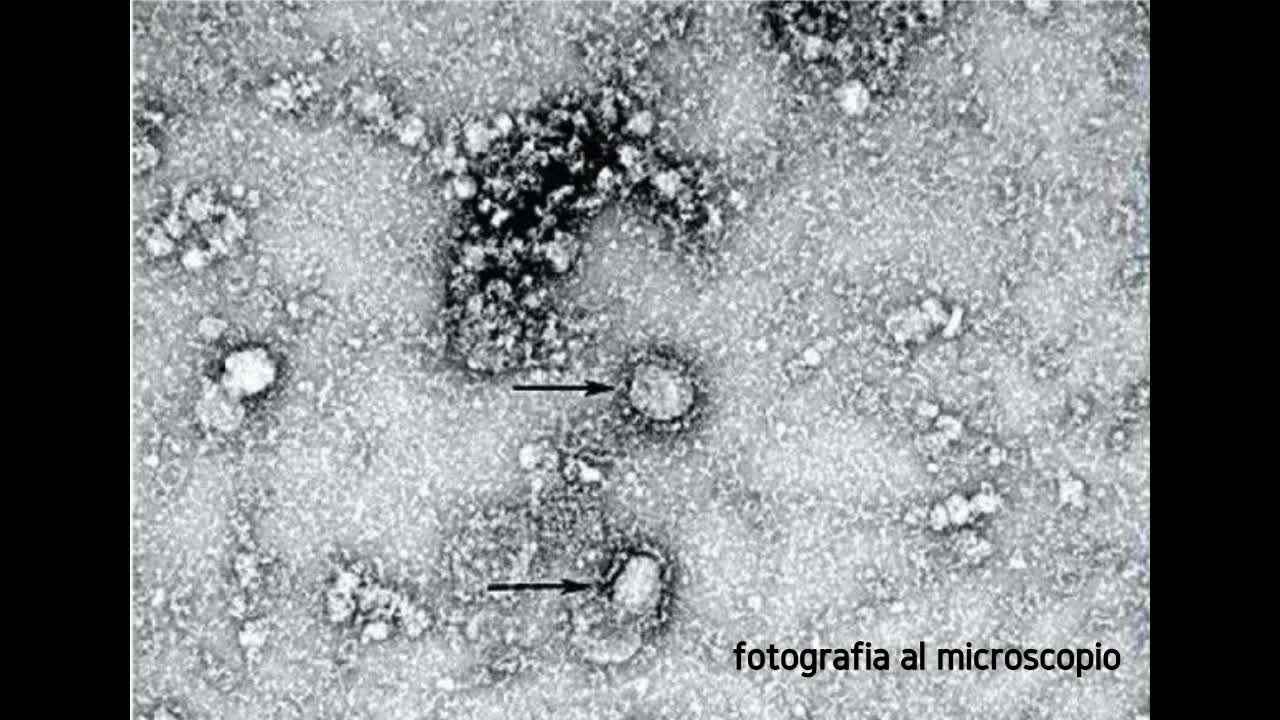 microscopi e orizzonte degli eventi