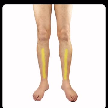 Got the mRNA Covid "Vaccine"? You better check your legs, as you may need a vascular surgeon!