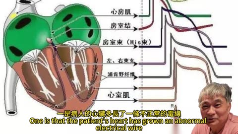 心律不整 電燒微創手術