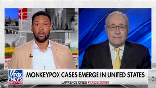 Another Mask Mandate for Monkeypox... Dr. Siegel Explains