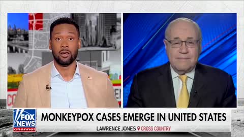 Another Mask Mandate for Monkeypox... Dr. Siegel Explains