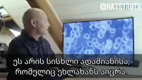 რას იწვევს ვაქცინა