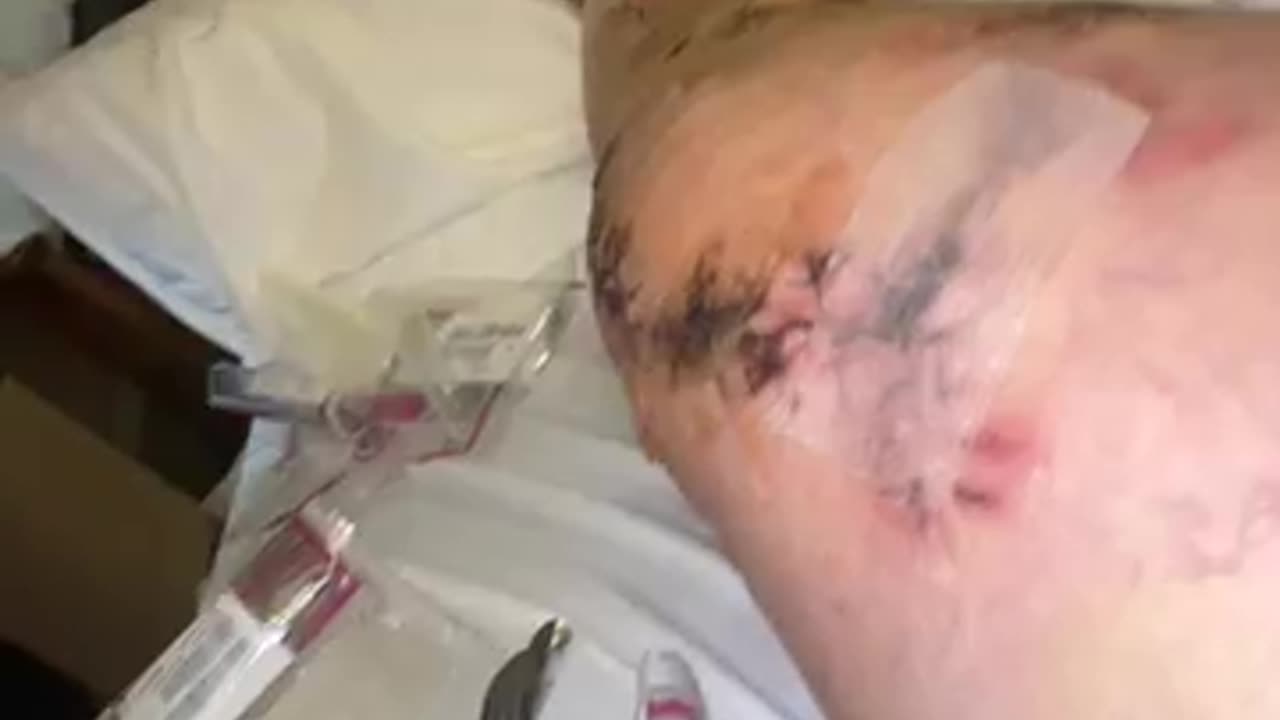 Wound check