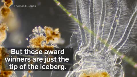 Ward- Winning Footage of micro species