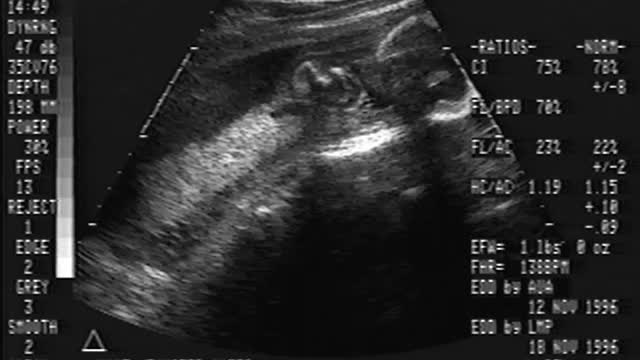 Blake Ultrasound