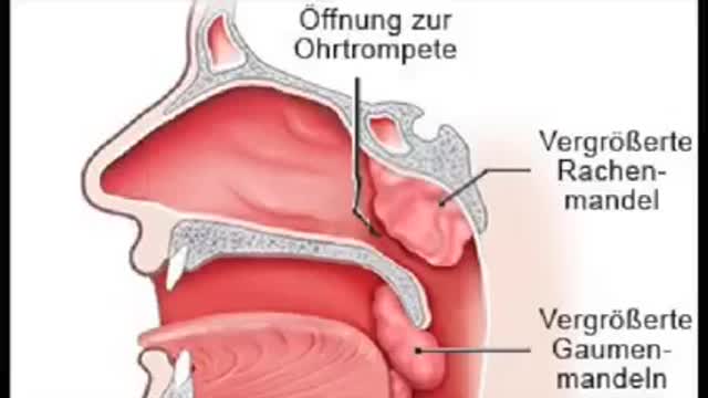 Dr. Thoma: Was unfachmännische Testungen anrichten können