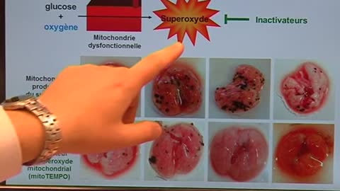 Belgian scientists claim success in blocking tumour metastasis