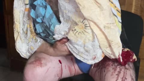 A captured soldier of the AFU. While he was getting to our positions, his own people shot him.