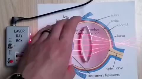 How astigmatism works