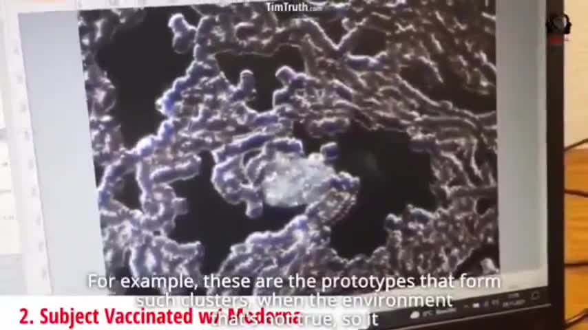 BLOOD EXAMINED UNDER MICROSCOPE IN REAL-TIME! VAXXED & UNVAXXED! YOU MAY WANT TO BE SITTING DOWN!!!