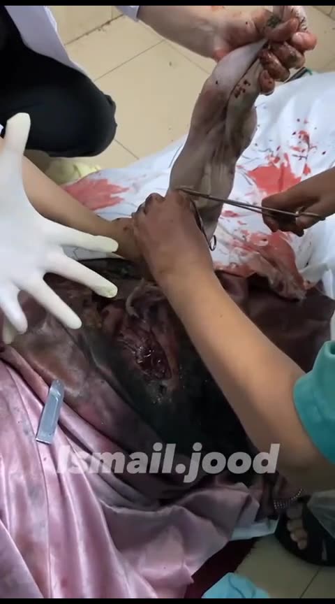 Oδυνηρό βίντεο από τη σφαγή στην Τζαμπαλία στη βόρεια Γαζα