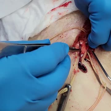 Protein spike this is what it causes in the human body (Dr Ryan Cole)